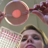 În Franța, se pregătesc primele teste clinice cu grefe de piele printate 3D. / Foto: bbc.com