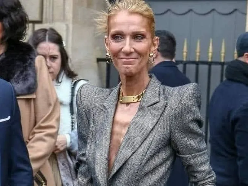 Celine Dion suferă de distrofie musculară. A ajuns la 40 de kilograme și nu mai poate să meargă. / Foto: unica.ro