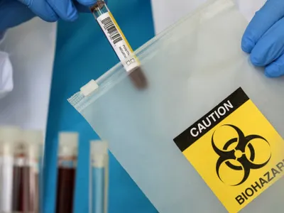 „Apocalipsa comandată prin poștă”. Epidemia de ciclosporiază din SUA expune pericolul unui viitor scenariu de coșmar: atacul biologic