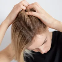 Ingredientul din bucătărie care te scapă urgent de mătreață. O pungă costă doar 10 lei - Foto: Istock / imagine cu rol ilustrativ