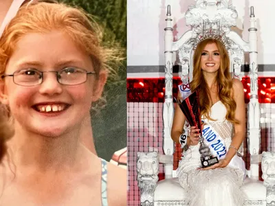 „Tocilara” umilită colegii de clasă a ajuns Miss Anglia. Acum are toată lumea la picioare - FOTO: Profimedia