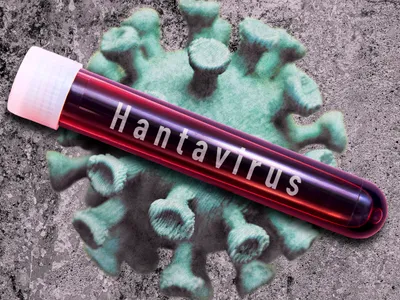 Hantavirus - Foto: Profimedia Images (rol ilustrativ)