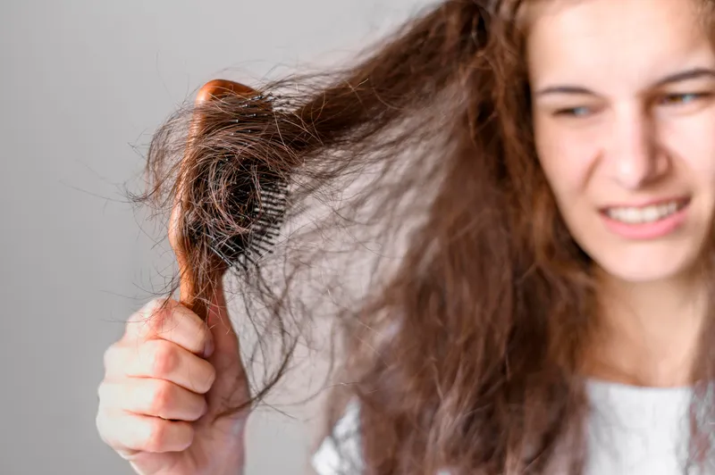 femeie care are alopecie Foto : Freepik (rol ilustrativ)