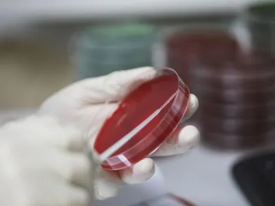 Ministrul Sănătății: Situația e mai bună, avem 247 de paturi libere la ATI