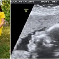 Detalii din cazul care zguduie lumea medicală: percheziții după moartea unui făt nenăscut/FOTO: ziaruldeiasi.ro
