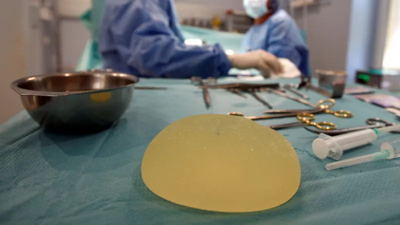 Scandalul implaturilor PIP cu silicon industrial: 2.700 de femei vor primi despăgubiri. / Foto: rt.com