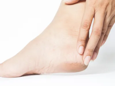 Călcâie uscate Foto: Freepik (imagine cu rol ilustrativ)
