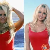 FOTO Obsesia pentru idolii lor îi aduc pe fani la "bisturiu" pentru a arata ca ei. Cum arată acum? - FOTO: Profimedia