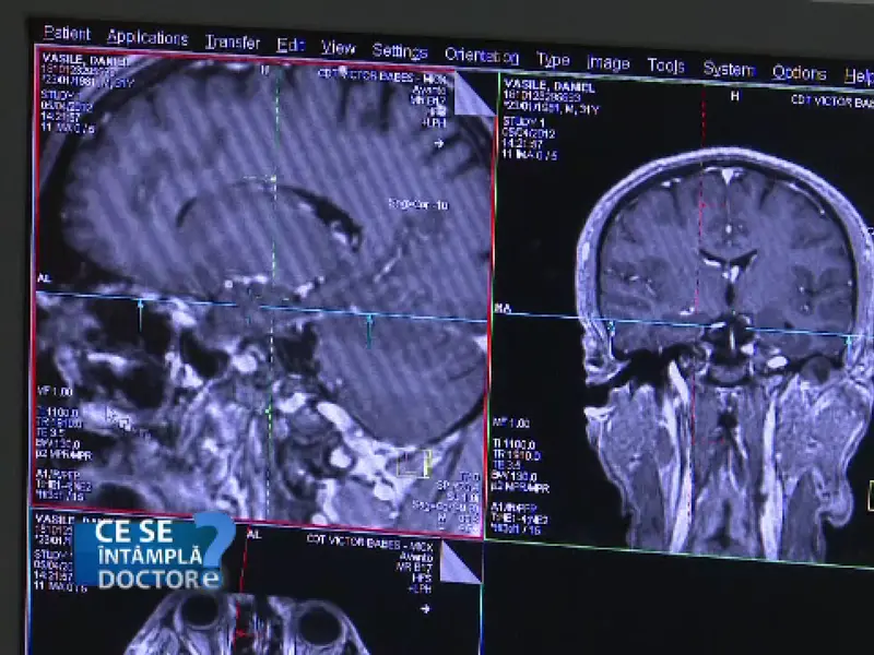 Ce s-a întâmplat în creierul unui bărbat după ce a consumat alcool și a făcut un RMN - Foto: Protv / imagine cu rol ilustrativ