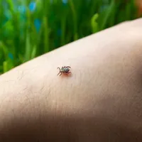 Căpușă - Foto: Freepik (rol ilustrativ)