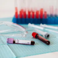 Un test de sânge ar putea prezice apariția unei boli grave. Peste 70.000 de români o au - Foto: Pexels.com (Imagine cu rol ilustrativ)