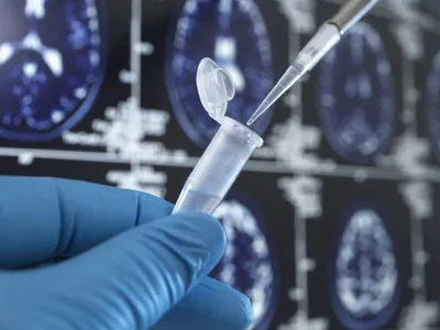 Un vaccin folosit de zeci de ani ar putea proteja creierul împotriva demenței. Descoperirea cercetătorilor americani