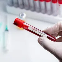 A trecut pandemia? 69 de cazuri noi de infectare cu SARS-CoV-2; aproape 16.000 de teste efectuate. Foto Pexels.com