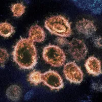 Foto: NATIONAL INSTITUTES OF HEALTH