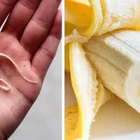 Secretul firelor din banană pe care le arunci mereu! De ce ar trebui să le mănânci de fapt? - Foto: Profimedia Images (imagine cu rol ilustrativ)