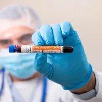 Alertă medicală în România. Val uriaș de rujeolă în mai multe județe. Un copil de 10 luni a murit - Foto: Profimedia images