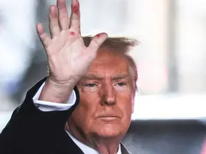 Ce sunt rănile de pe mâinile lui Donald Trump - Foto: Digi24.ro/Profimedia Images