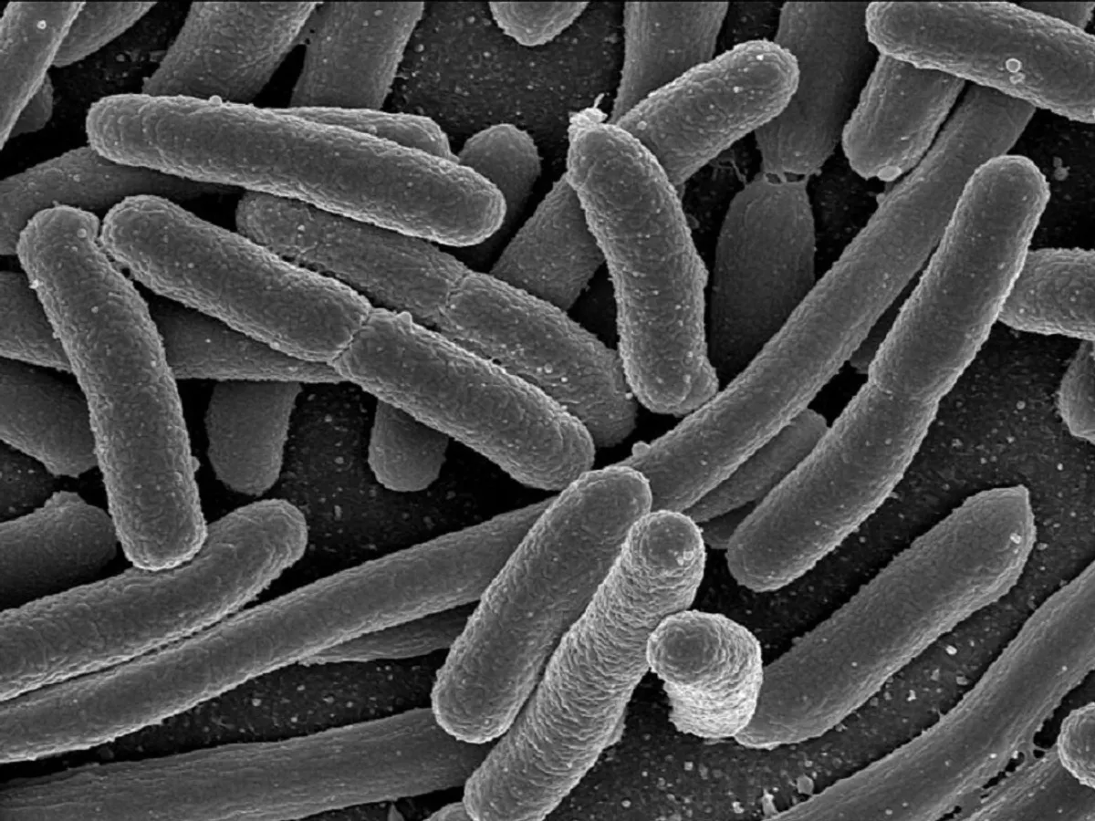 Bacteria E. coli