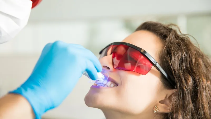 Dinți albi în 3 zile! Transformă-ți zâmbetul înainte de evenimente importante cu albirea dentară profesională