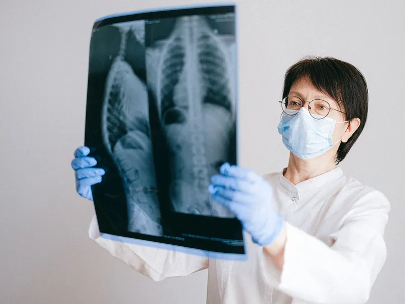 Medicii au văzut ceva suspect la radiografie (foto cu caracter ilustrativ) Foto: pexels.com