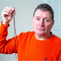 Britanicii își scot singuri dinții și măselele.folosind șireturile de la pantofi - Foto: Adam Gerrard / Daily Mirror