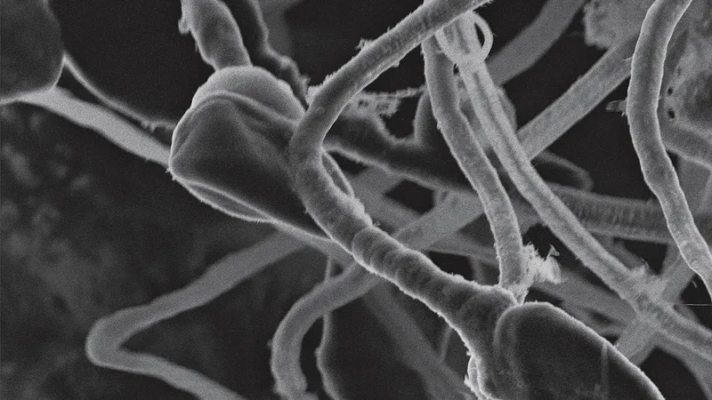 Spermatozoizii