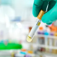 Semnal de alarmă: Aproape 3.000 de români din sudul ţării, depistaţi cu hepatita B sau C. - Foto: Profimedia Images