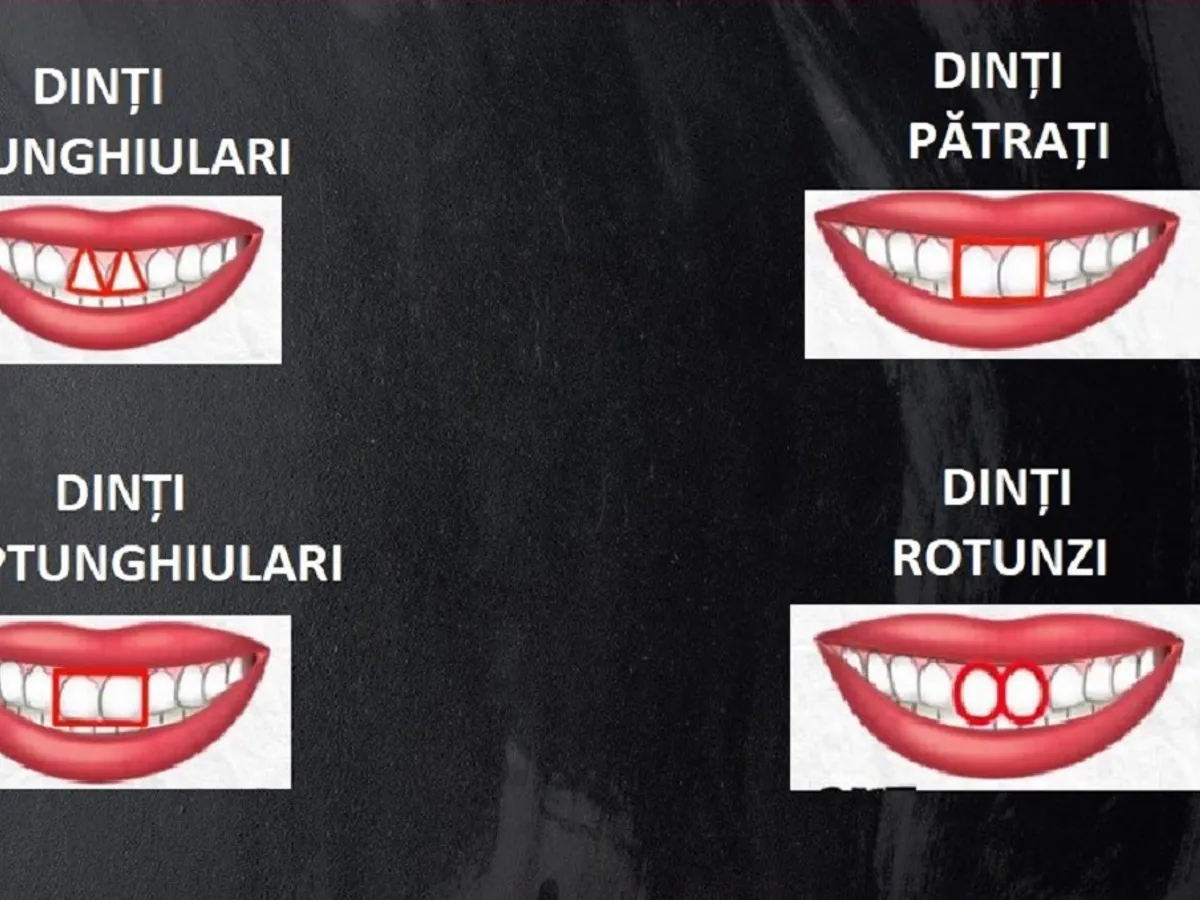 dinți