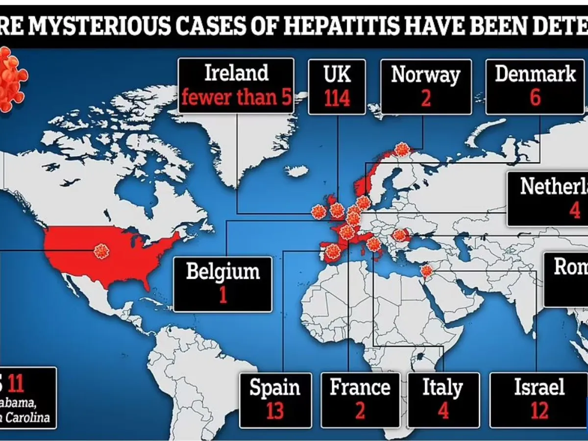 Hepatita misterioasă, ce a dus la un deces și 17 transplanturi de ficat, a ajuns și în România/foto: dailt mail