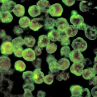 Un american a fost ucis de Ameba Naegleria, care mănâncă creierul _ Foto: Sky News