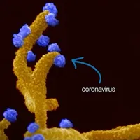 Celule infectate cu Sars-Cov-2.