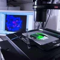 Nouă speranță, pentru bolnavii de cancer de sânge tip „LLC”. SUA au aprobat medicamentul Jaypirca - Foto: Profimedia Images - Imagine cu rol ilustrativ