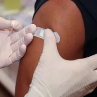 Țară europeană cu număr uriaș de români, primul caz de infectare cu noua variantă mpox clada Ib - FOTO: Profimedia(imagine cu rol ilustrativ)