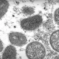 Mpox se răspândește  cu viteză în lume.: Un întreg continent a declarat urgență de sănătate pubică - Foto: captura Youtube(imagine cu rol ilustrativ)