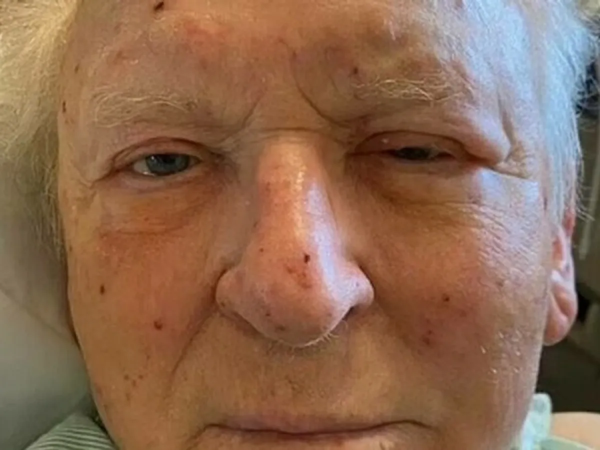 Un bărbat în vârstă de 81 de ani a agonizat timp de trei ore după ce a fost atacat de peste 200 de albine Foto: GOFUNDME.COM