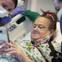 Transplant la om, cu rinichi de porc. Este a doua oară la nivel mondial când se întâmplă - Foto: Profimedia Images