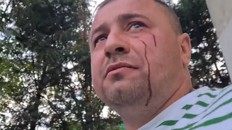 Activistul Robert Nițu a fost urmărit de interlopi care i-au tamponat mașina și l-au bătut chiar și de față cu polițiștii Foto: captură Youtube
