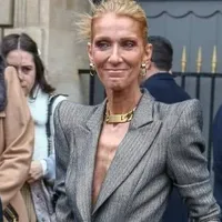 Celine Dion suferă de distrofie musculară. A ajuns la 40 de kilograme și nu mai poate să meargă. / Foto: unica.ro