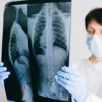 9 din 10 persoane din lume respiră aer poluat. Cum ne afectează sănătatea? Foto: Pexels (fotografie cu caracter ilustrativ)