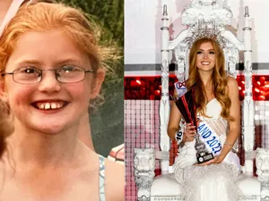 „Tocilara” umilită colegii de clasă a ajuns Miss Anglia. Acum are toată lumea la picioare - FOTO: Profimedia