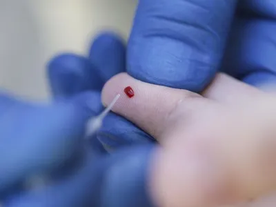 Care tulpină e mai  rea: britanică, braziliană, sud-africană și indiană. Foto Inquam Photos/Octav Ganea