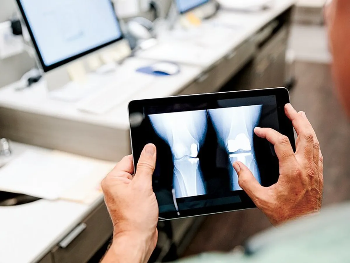 Un doctor privește radiografiile unui genunchi pe o tabletă