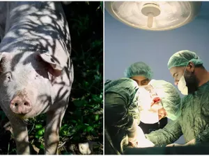 Un plămân de porc transplantat la un pacient aflat în moarte cerebrală. Cum a mers? - Foto: Arhiva