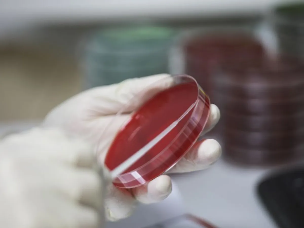 Ministrul Sănătății: Situația e mai bună, avem 247 de paturi libere la ATI