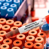 Hepatita C - Foto: Profimedia Images