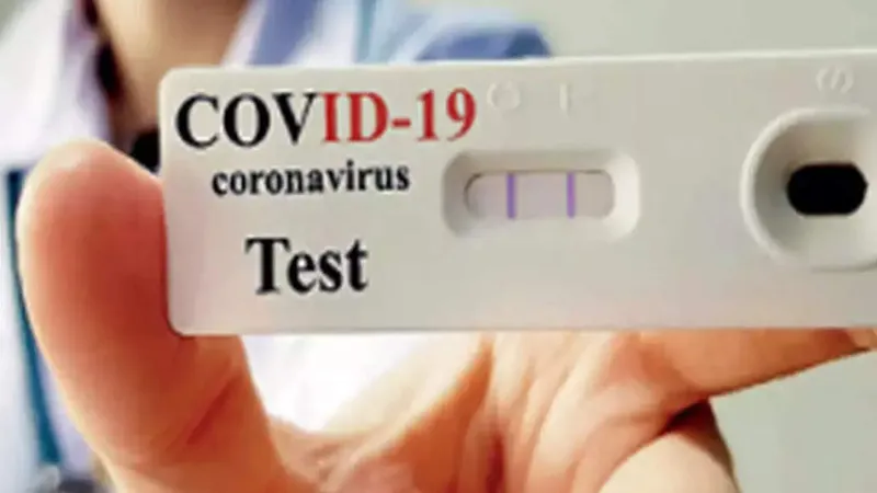 OMS: Testele PCR detectează noua variantă SARS-CoV-2 „Omicron”/foto: times of africa