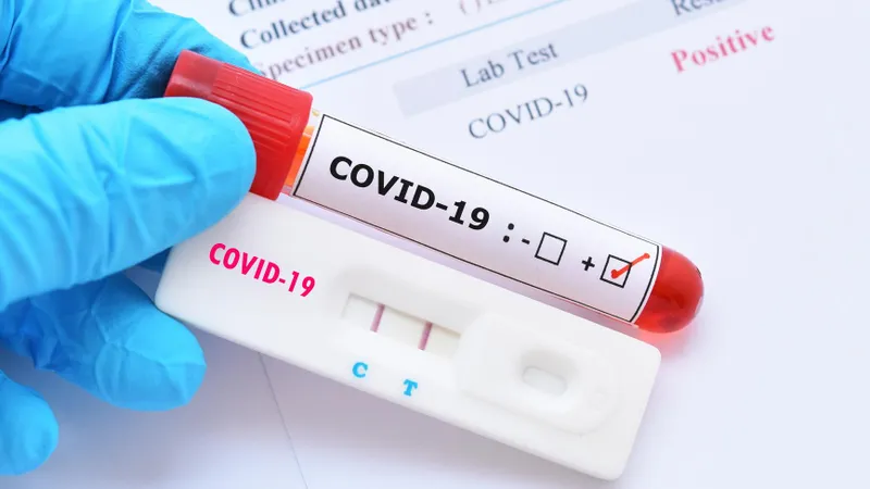 UK nu mai cere confirmarea prin test PCR a rezultatului pozitiv furnizat de un test COVID rapid. / Foto: cz.usembassy.gov