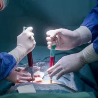 În România nu se mai poate face transplant pulmonar / digi24