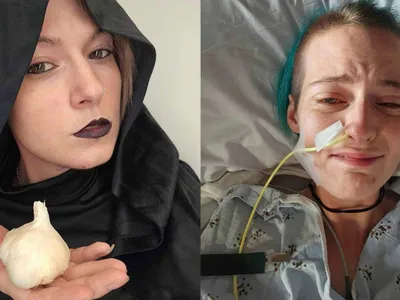 „Boala vampirilor”, metoda prin care o femeie poate muri dacă mănâncă usturoi. Ce o declanșează? - Foto: Profimedia Images (imagine cu rol ilustrativ)