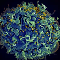 O nouă variantă de HIV, mai virulentă, a fost identificată în Țările de Jos/FOTO: Pixabay